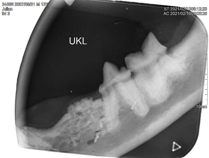 Dentalröntgen FORL Typ II