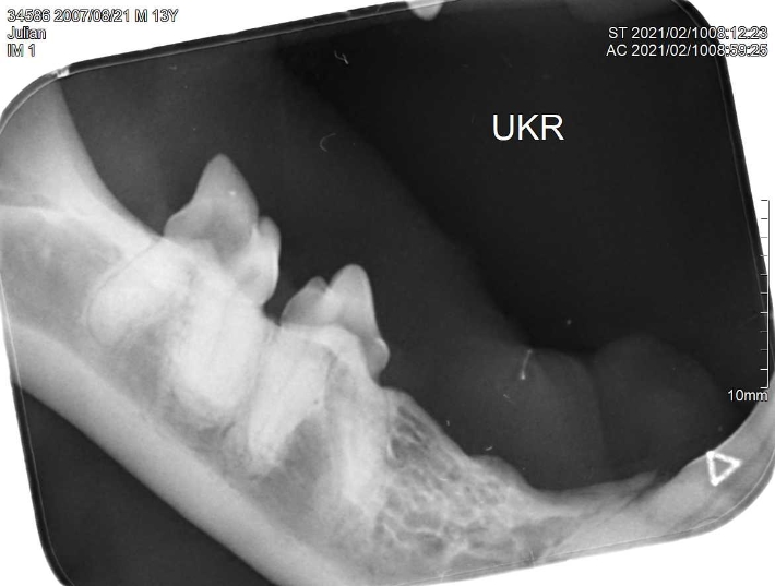 Dentalröntgen FORL Typ II